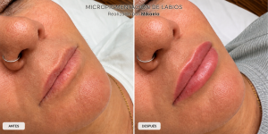micropigmentacion labios